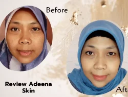 Review Adeena Skin