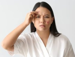 Bukan Cuma Obat Jerawat Biasa, Haloskin Beneran Bikin Kulitmu Sehat!