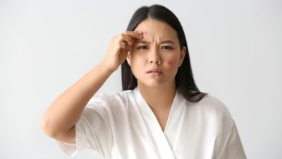 Bukan Cuma Obat Jerawat Biasa, Haloskin Beneran Bikin Kulitmu Sehat!